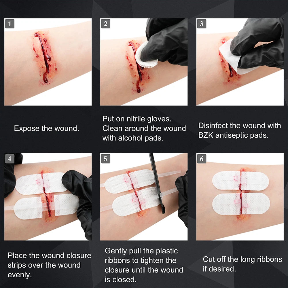 RESCUE Zip Stitch 6pcs ,Wound Dresssings, Wound Closure Strips, Zipstitch Laceration Closure Kit