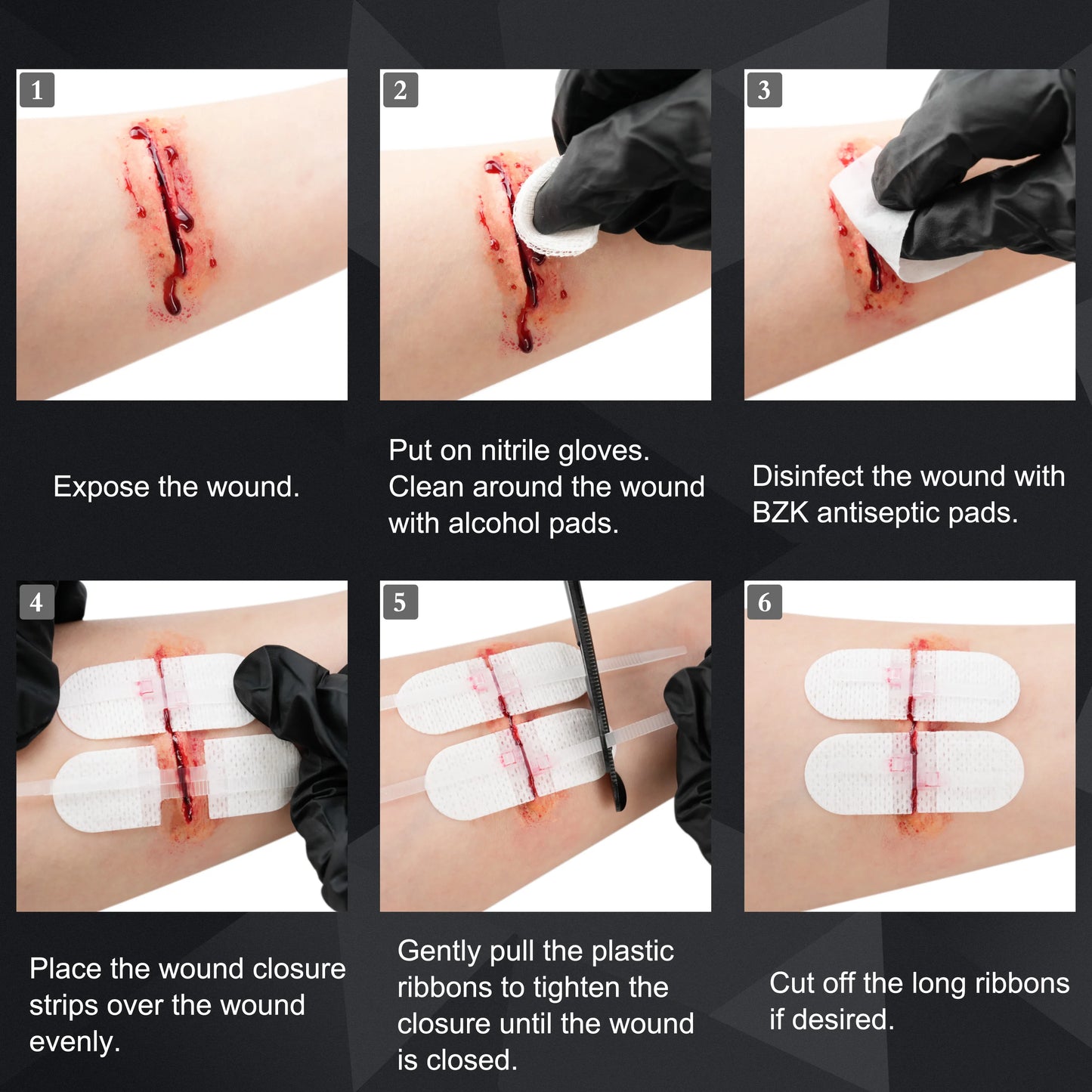 RESCUE Zip Stitch 6pcs ,Wound Dresssings, Wound Closure Strips, Zipstitch Laceration Closure Kit