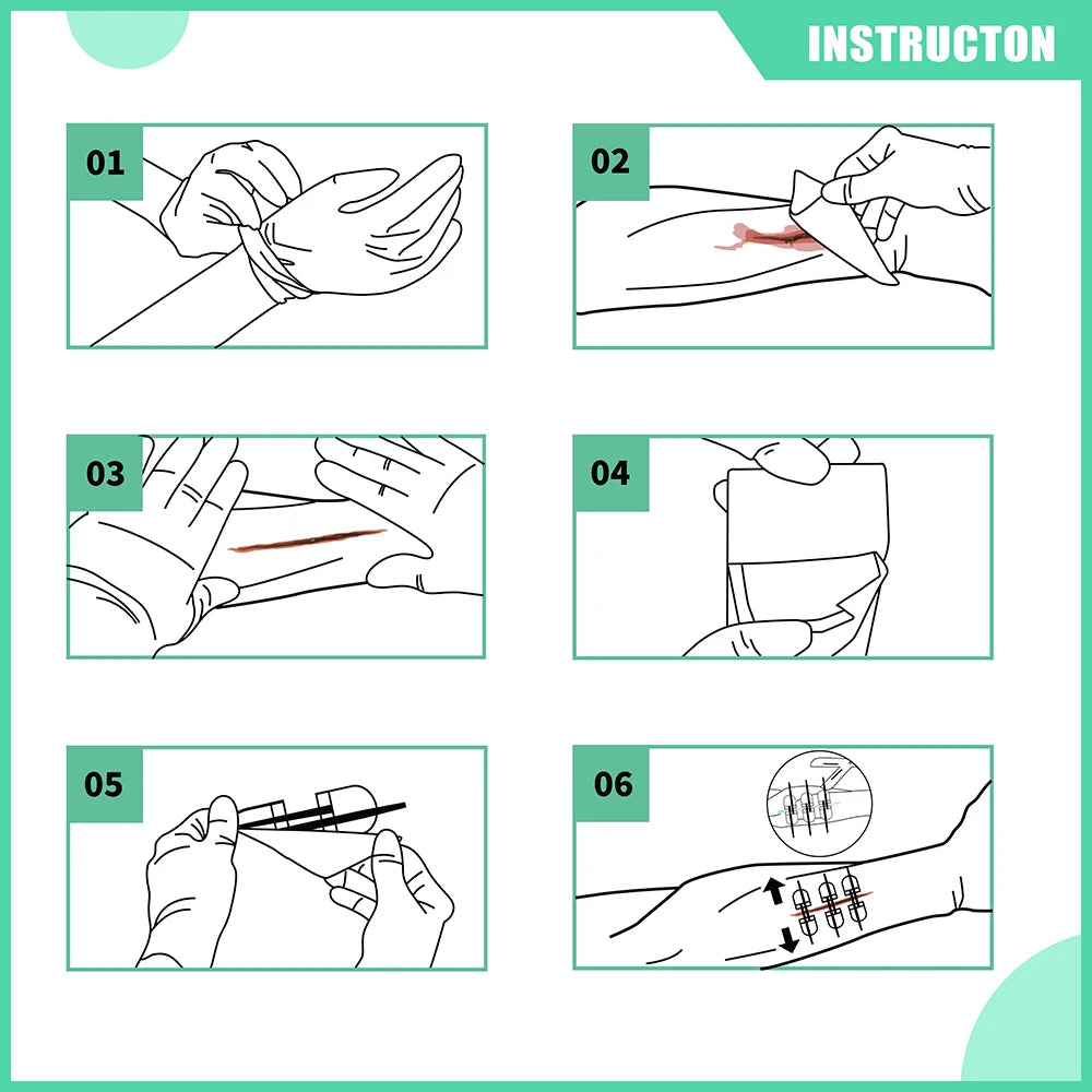 RESCUE Zip Stitch 6pcs ,Wound Dresssings, Wound Closure Strips, Zipstitch Laceration Closure Kit