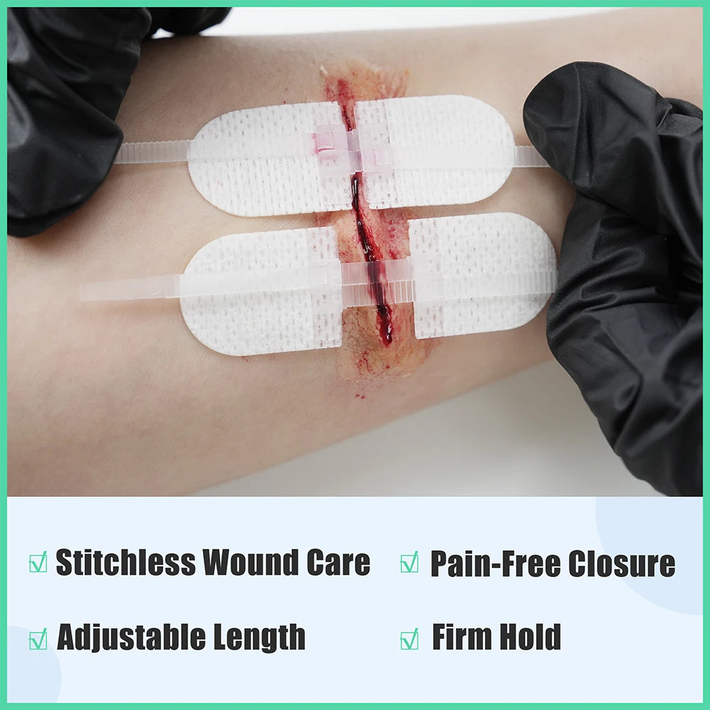 RESCUE Zip Stitch 6pcs ,Wound Dresssings, Wound Closure Strips, Zipstitch Laceration Closure Kit